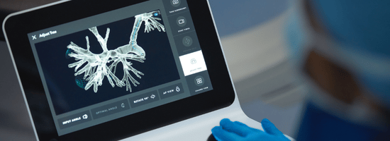 A display screen on the the Ion Robotic Bronchoscopy platform. 